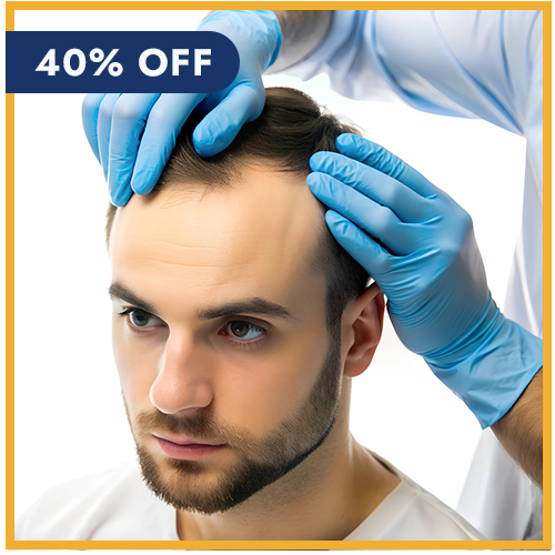 Hair Transplant Treatment